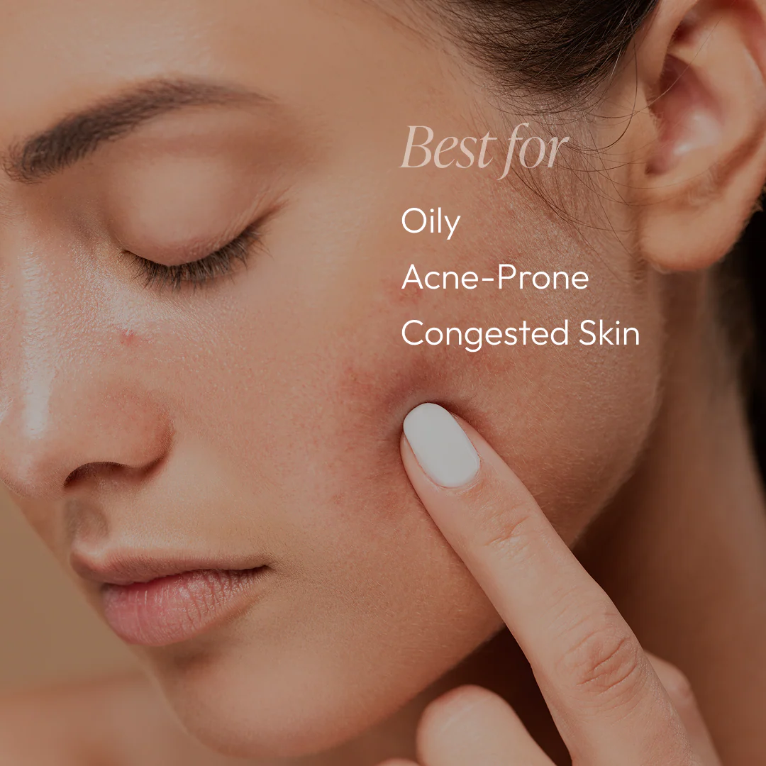 Acne Essentials Regimen Kit - Image 11