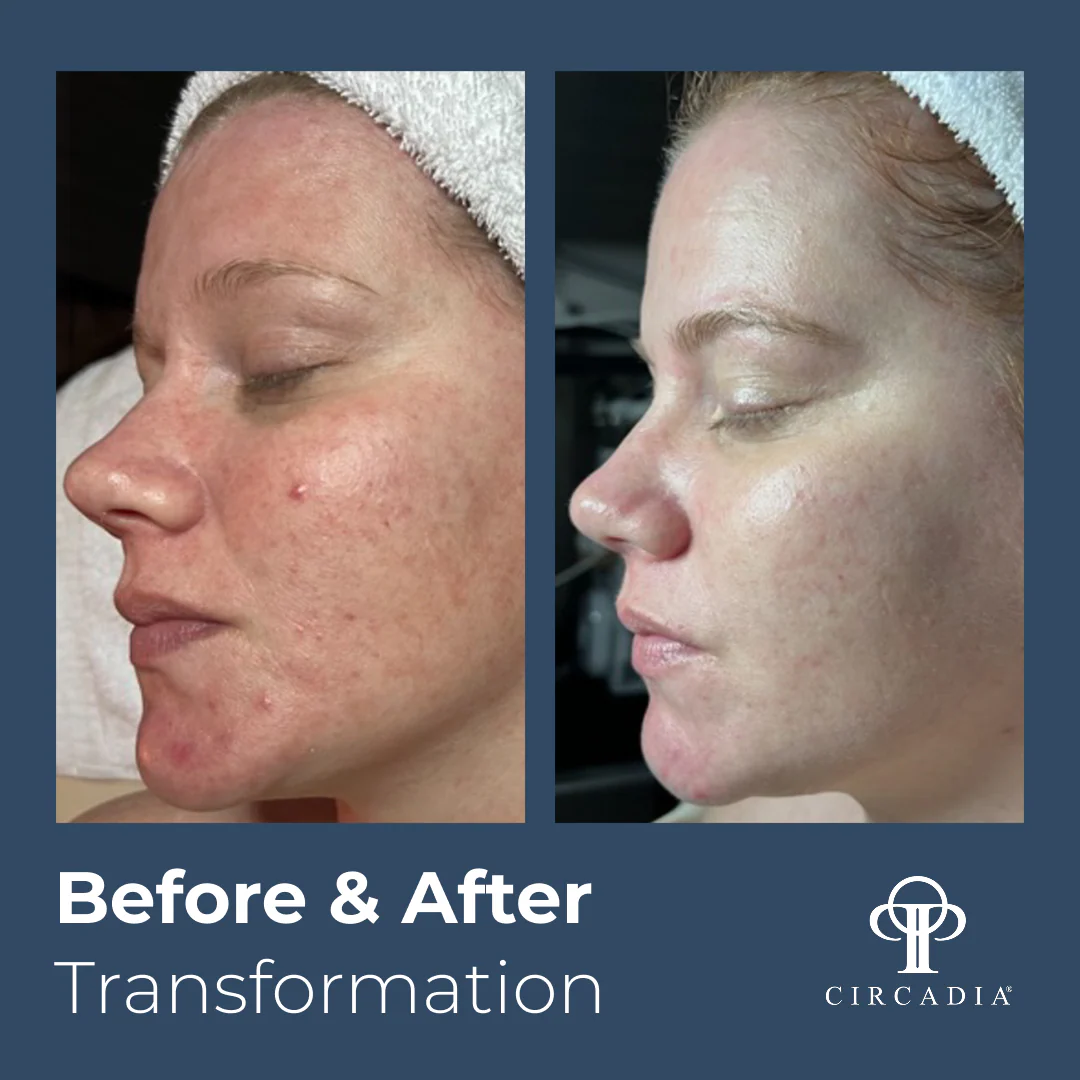 Calming Signature Facial Complete Bundle - Image 3