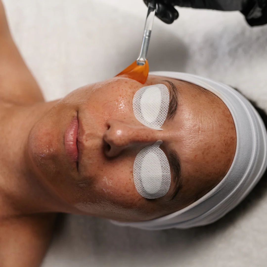 Eye Shields - Image 8
