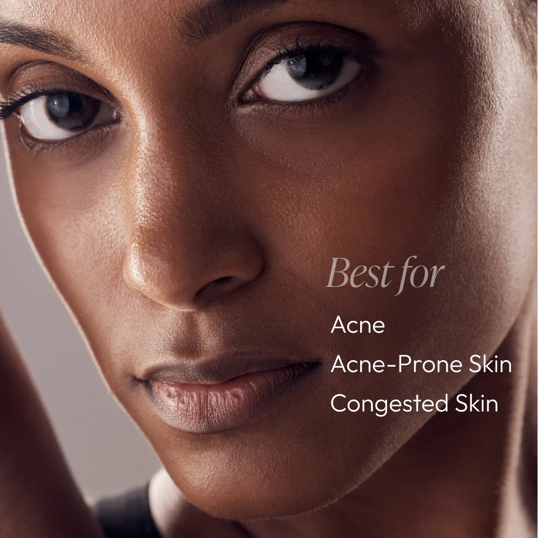 Nighttime Control Acne Treatment Lotion - Image 4