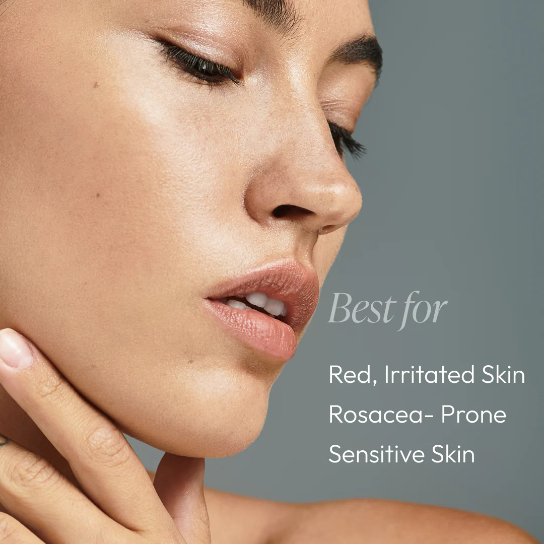 Rose-Ease Relief Cream - Image 4