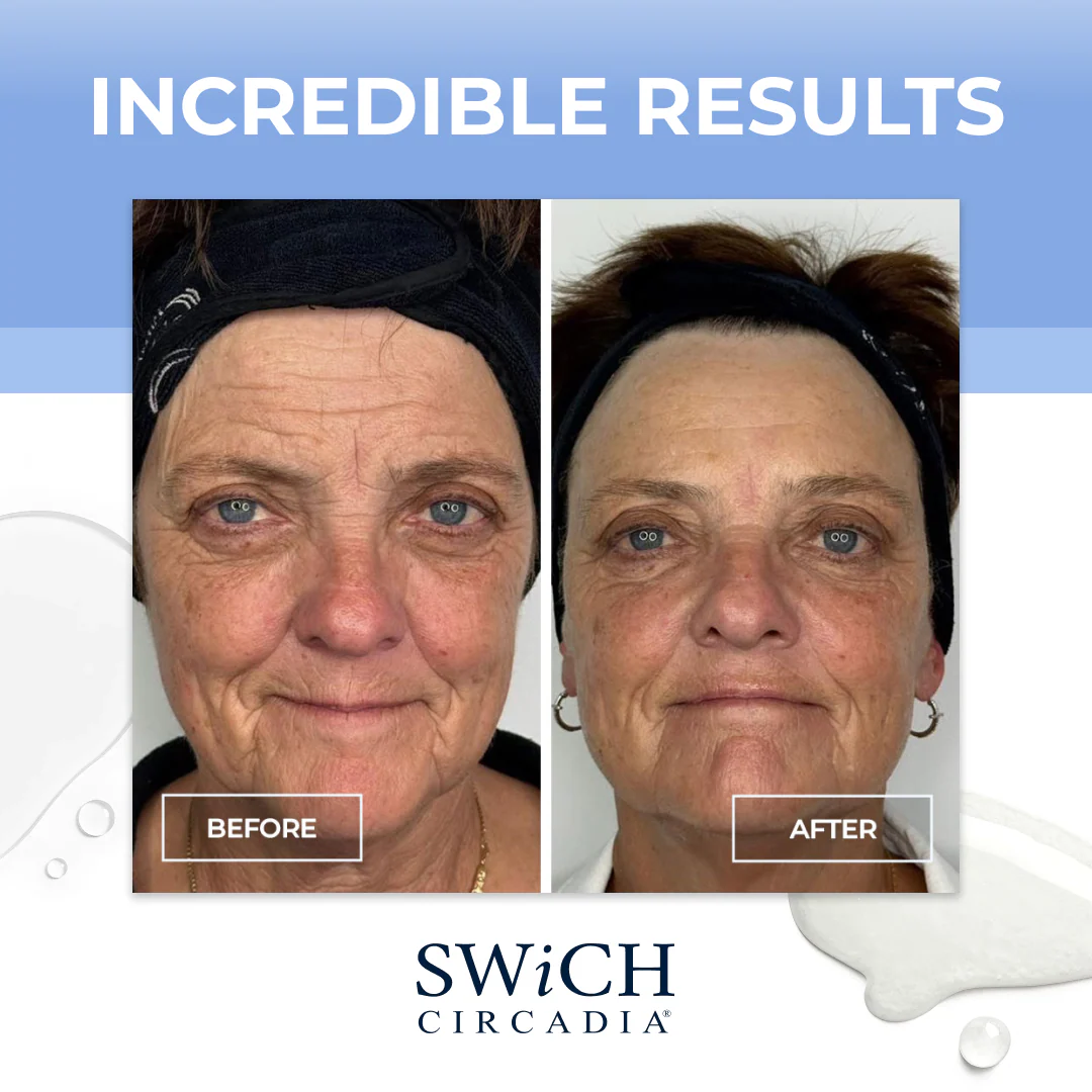 SWiCH Signature Facial - Image 6