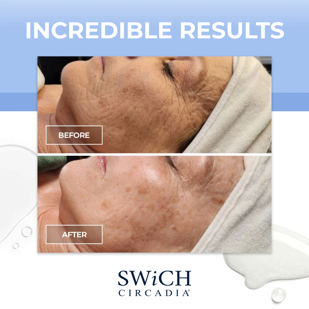 SWiCH Signature Facial - Image 8